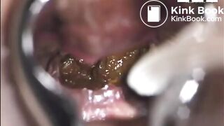 ScatKings.com Scat Porn
